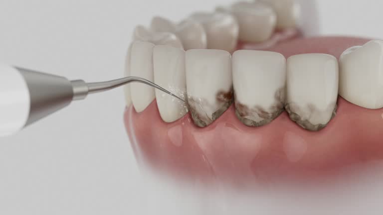 Reliable Emergency Dentist contractor in Clayton, MO by Smile Center Dentistry